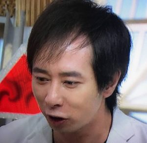 おでこが光るほどハゲが進行