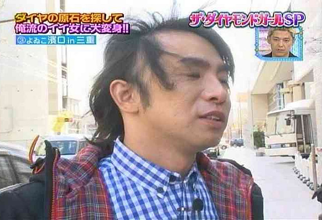 深刻なほどの薄毛