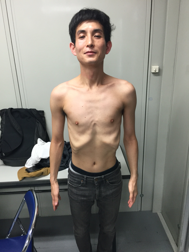 体重41kg