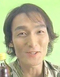 M字ハゲ異常に深刻な薄毛