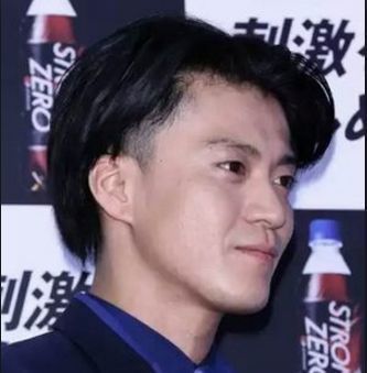 M字ハゲは深刻な模様