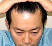 ハゲ迫時代の方が面白かった？