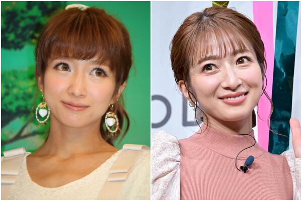 「鼻が大きくなった」のは整形?