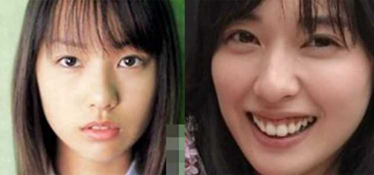 明らかに鼻が大きくなっている