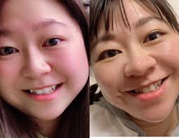 鼻が横に大きく広がっている